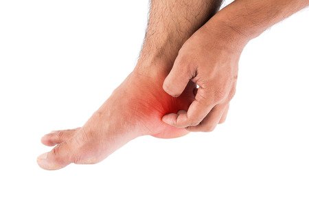 7 Cara Mengatasi Telapak Kaki yang Gatal dan Merah