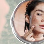10 Cara Alami Menghilangkan Bintik Hitam di Dagu